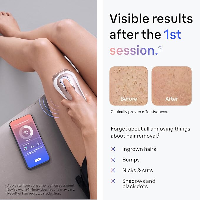 Braun IPL Skin i·expert, at Home Laser Hair Removal, Permanent Visible Hair Reduction, Holiday Gifts for Women and Men with Free App, SMART IPL, Vanity Case, Venus Razor, 4 Smart Heads, PL7387