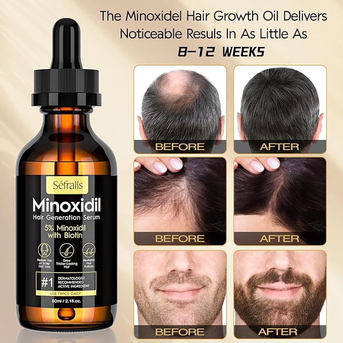 5% Minoxidil Hair Growth Oil for Men & Women Kit - Extra Strength Regrowth Serum, Topical Hair Loss Treatment Serum, Thicker, Healthier Hair & Beard Growth Kit, 2.11 fl.oz
