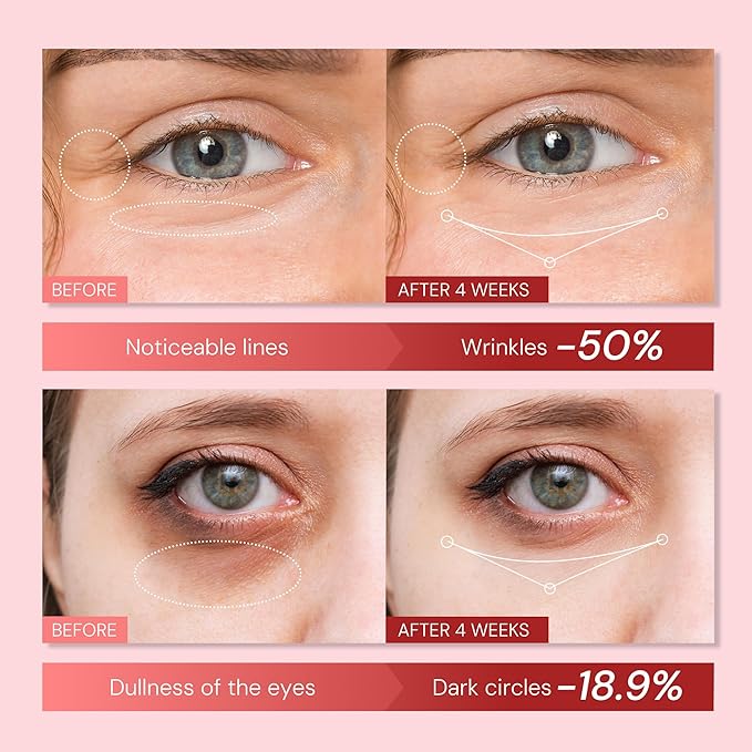 Retinol Eye Cream Anti Aging: Instant Eye Tightener & Wrinkle Repair Moisturizer - Under Eye Bags Treatment for Women - Peptide Eye Serum Reduce Dark Circles & Puffiness, 0.85 fl.oz