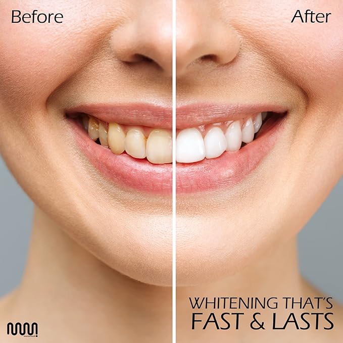 MasterMedi Teeth Whitening Strips, Non-Sensitive White Strip for Teeth Whitening, 14 Treatments
