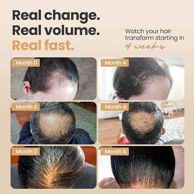 Vitasei Hair Booster 2 Fl Oz (2 Pack) – Revitalizing Serum with Capilia Longa, Wild Olive Stem Cells & Arginine – Peptide-Enriched Hair Tonic Supports Thicker, Stronger Hair – For Women & Men