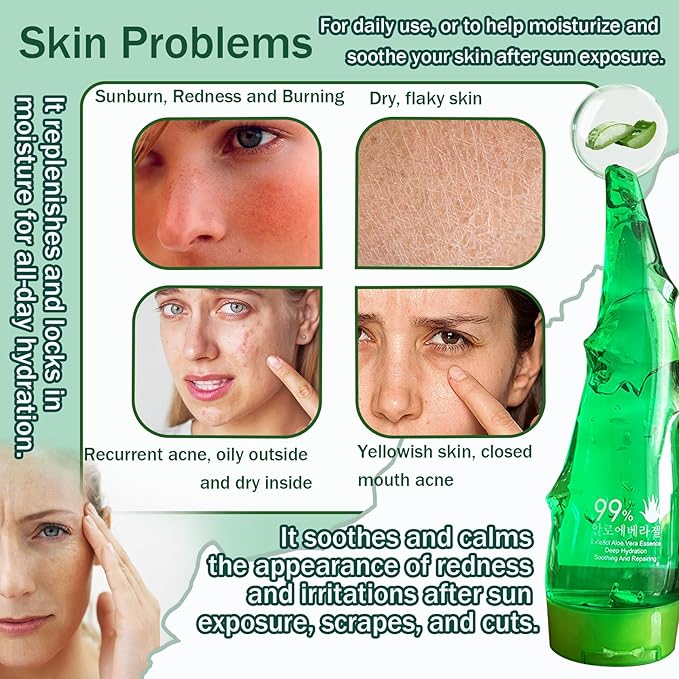 JunKuJK 99% Purity Aloe Vera Gel - Hydrating Aloe Vera Gel for Face and Skin,No Sticky Moisturizing Aloe Gel(5 pcs) B