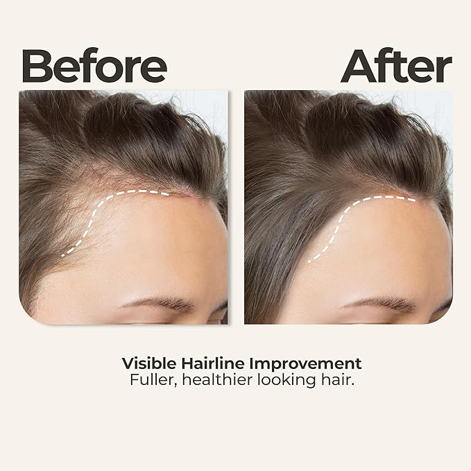 Organic Rosemary Coconut Oil + Head Massager Hair Growth Set — Strengthening Biotin Hair Thickening Serum – Dry Scalp, Frizzy, Damaged Split Ends Treatment – Color Safe, All Hair Types – 5oz Bundle