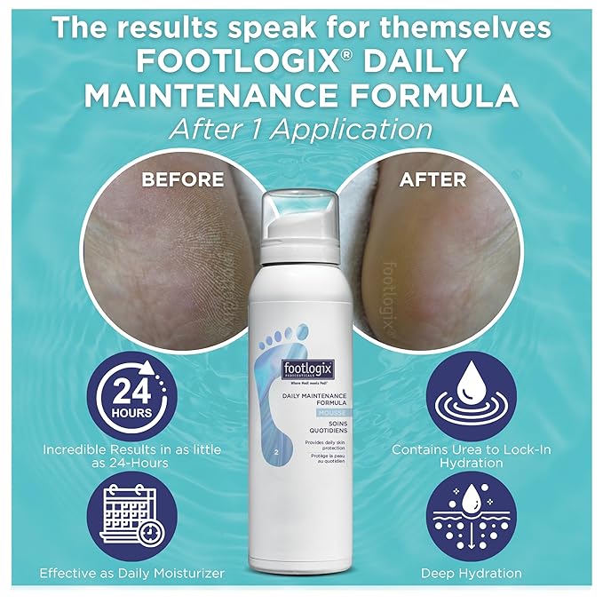 FOOTLOGIX Daily Maintenance Formula - Foot Moisturizer, Foot Mousse for Normal to Dry Skin Maintenance, Foot Mousse for Calluses and Dry Feet, 4.23oz