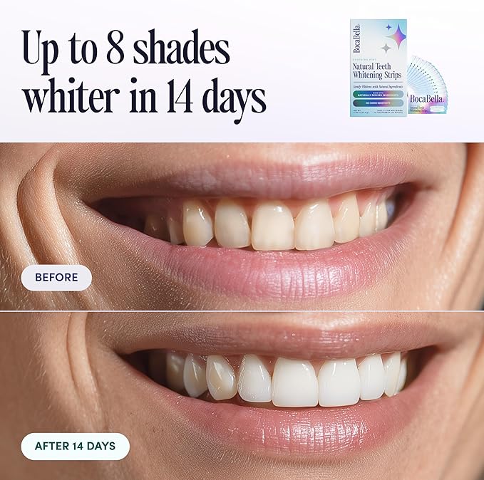 Teeth Whitening Strips for Sensitive Teeth – Natural, Peroxide-Free & Enamel-Safe | Clinically Tested Papaya & Pineapple Enzymes + Aloe & Coconut Oil | 14 Treatments for a Brighter, Whiter Smile
