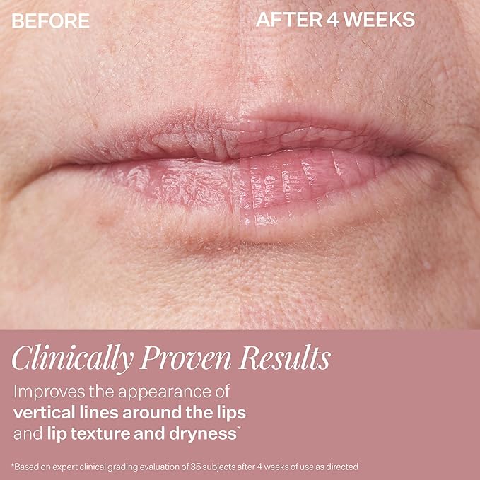 StriVectin DoubleFix For Lips 2-in-1 Lip Fix Plumping Treatment & Vertical Line Treatment
