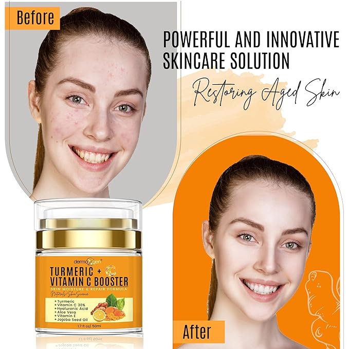 Dermaxgen Turmeric Face Cream with 30% Vitamin C – Glow Booster, Anti-Aging & Skin Repair Moisturizer for Dark Spots, Hydration & Radiance – Vitamin C Cream for All Skin Types (1.7 fl oz)