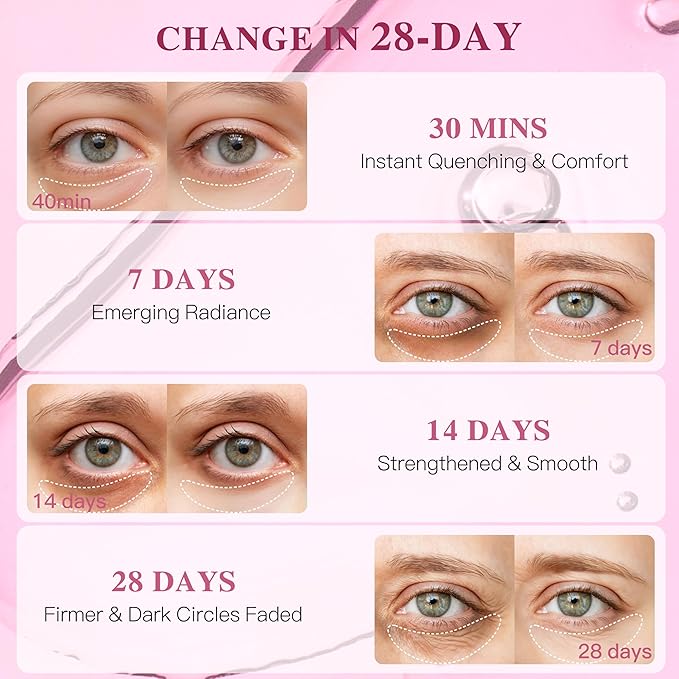 IICIKOL Collagen Under Eye Patches for Puffy Eyes and Dark Circles, Under Eye Mask for Wrinkle with Ginseng, Deep Hydrating Undereye Mask Patches, Christmas Small Gifts for Women (60 Pairs, Ginseng)