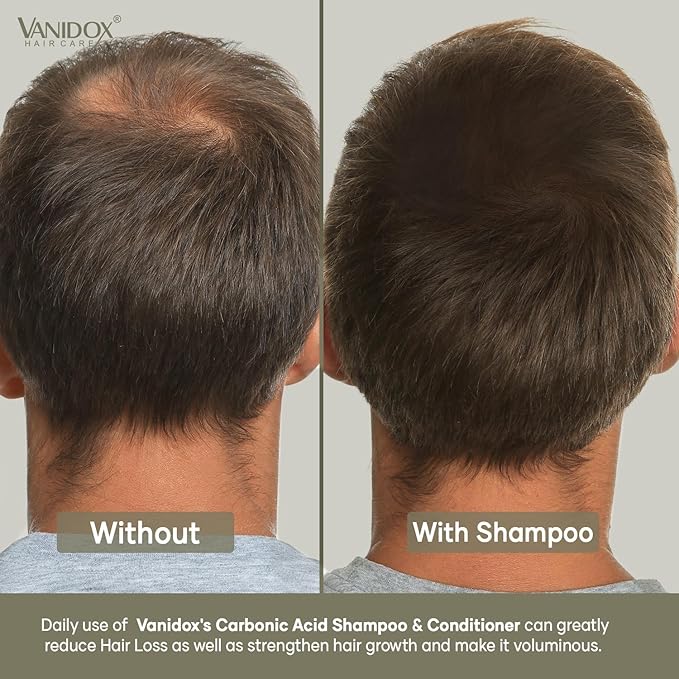 VANIDOX Carbonic Acid Shampoo and Conditioner for Men and Women, Deep Moisturizing Conditioner Thickens, Softens, & Smooths Set for Hair Growth and Repair, Made in USA - 16 Fl Oz Each
