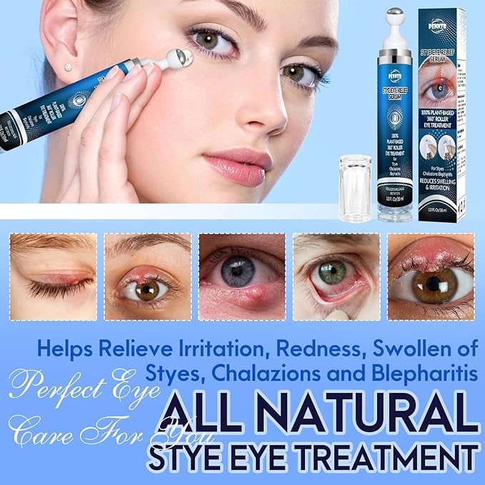 Stye Eye Treatment, Eye Serum for Stye, Chalazions & Blepharitis Roller Serum, Natural and Plant-based Formula (1 Fl Oz)