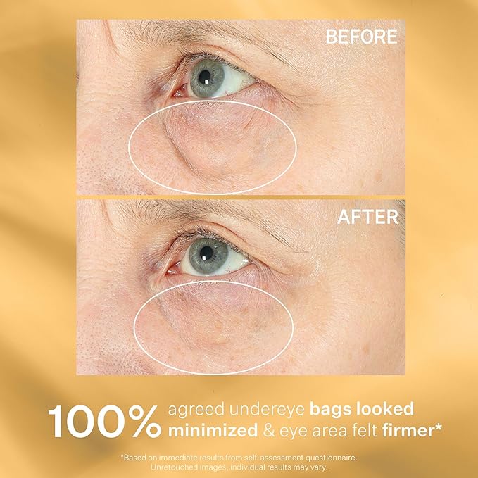 StriVectin Tighten & Lift Hyperlift Eye Cream Instant Eye Fix, Tightening Treatment for Bags, Lines and Crepiness, 0.34 Fl Oz,(Pack of 1)