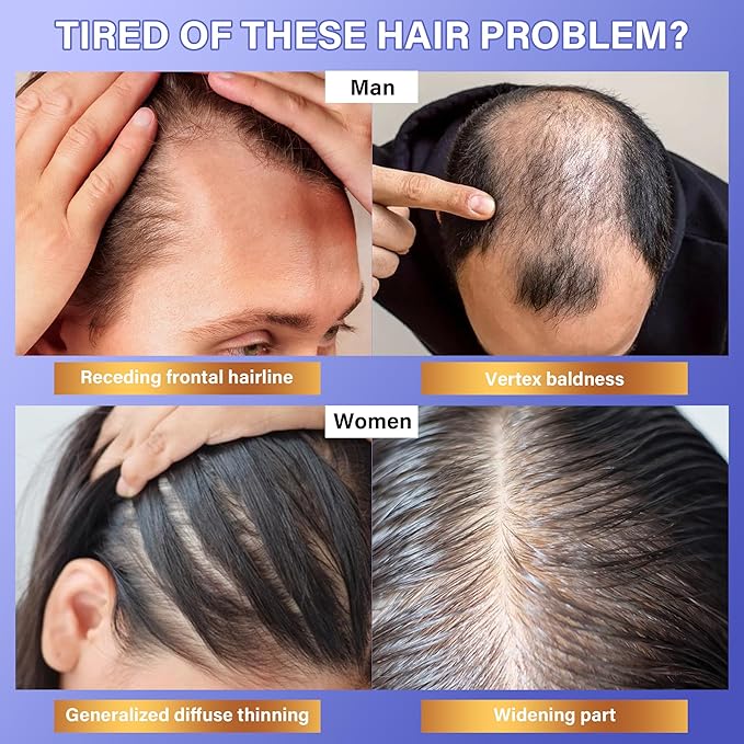 Rosemary Hair Growth Serum - Hair Scalp Oil with Organic Rosemary Essential Oil, Upgraded Plant-Based Formula to Invigorate Follicles Strengthen Roots and Reduce Loss & Bald Patches for Men & Women