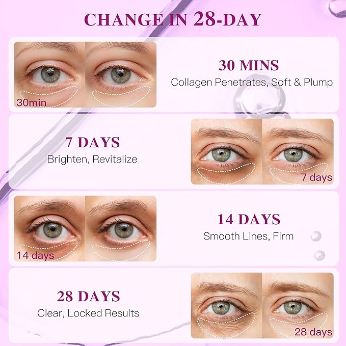 ICIKOL Collagen Under Eye Patches Mask - Undereye Patches for Dark Circles, Puffiness, Wrinkles - Gel Under Eye Patches, Birthday Gifts for Women - Gifts for Women - Vegan (12 Pairs, Pearl Powder)