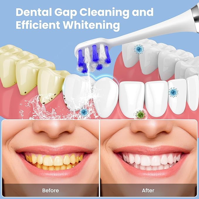 UNINGOPI Portable Electric Toothbrush with Water flosser, 2 in 1 Teeth Cleaning Kit, Electricc, Toothbrush and Water flosser Combo, Travel Toothbrush with Water Bottle(White)