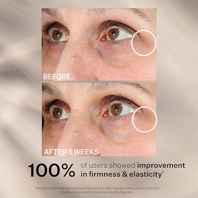 StriVectin Contour Restore™ Firming Moisture Balm for Eyes, Visibly Restore & Resculpt Eye Area (Pack of 2)