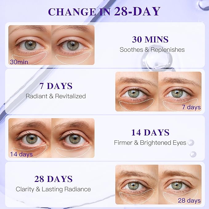 ICIKOL Collagen Under Eye Patches for Puffy Eyes and Dark Circles, Under Eye Mask for Radiance Boost, Deep Hydrating Undereye Mask Patches for Treatment with Women Beauty (24 Pairs, Grape seed)