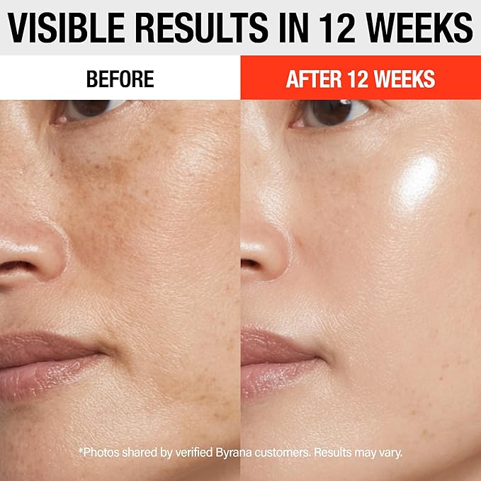 BYRANA Vitamin C Brilliant Glow Face Serum – Korean Anti Aging Skincare with THD Ascorbate, Matrixyl 3000, Ferulic Acid & Ginseng – Visibly Reduces Dark Spots, Uneven Tone, Fine Lines & Wrinkles