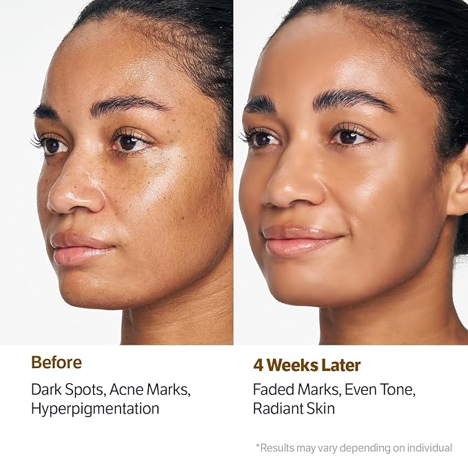 SUNGBOON EDITOR Kojic Turmeric Capsule Brightening Cleanser for Uneven Spots, Acne-prone Skin & Blackhead | Low pH Gentle Gel Face Wash | Encapsulated Kojic Acid & Niacinamide | Korean Skincare