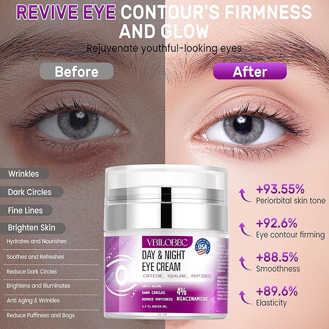 Vbilobec 2025 Latest Caffeine Eye Cream:[30+ SGS Certified] [Used by Over 1M Fans] Anti-aging Eye Cream to eliminate dark circles, puffiness, and fine lines.1.7 fl oz, for Women& Men,3PC