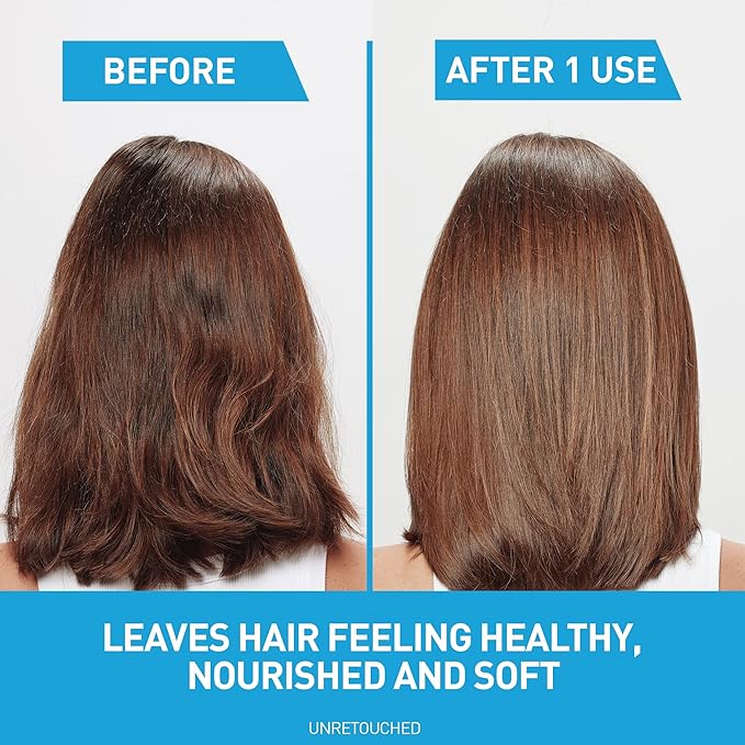 CeraVe Hydrating Anti Dandruff Conditioner, 0.5% Pyrithione Zinc Dandruff Treatment With Ceramides, Hyaluronic Acid & Niacinamide, Helps Eliminate Flakes & Reduce Itchy Scalp, Sulfate Free Conditioner