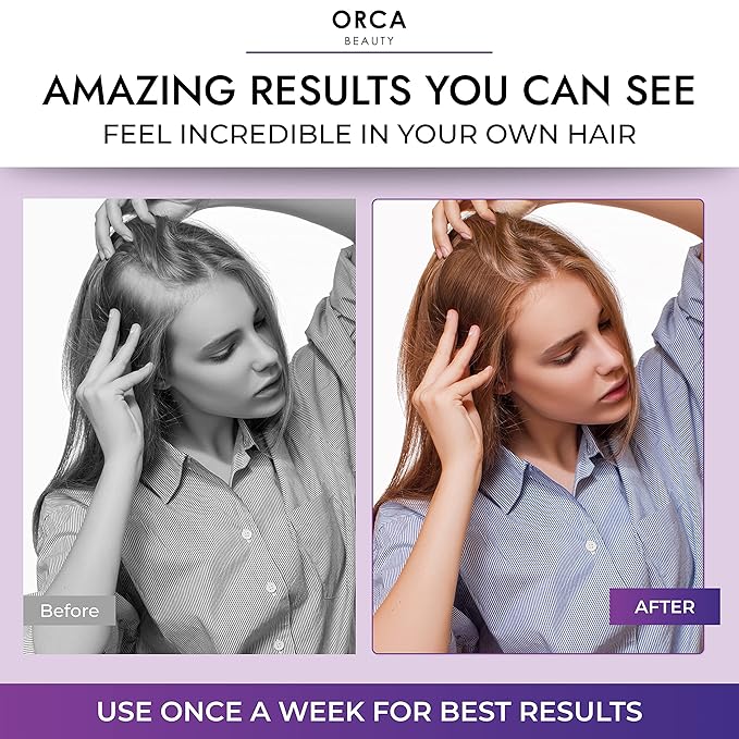 Biotin Shampoo and Conditioner for Women and Men - Volumizing Shampoo and Conditioner Set to help boost thinning hair - Hydrating, Nourishing Hair Loss Shampoo and Conditioner