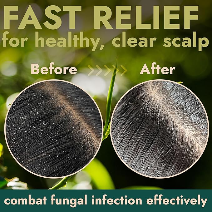 Tea Tree Scalp Scrub | Itchy & Dry Scalp Care with Tea Tree Oil, Quartz Powder & Sea Salt | Gently Exfoliates, Helps Reduce Flakes, Supports Healthy Hair Growth & Scalp Balance (pack of 2)