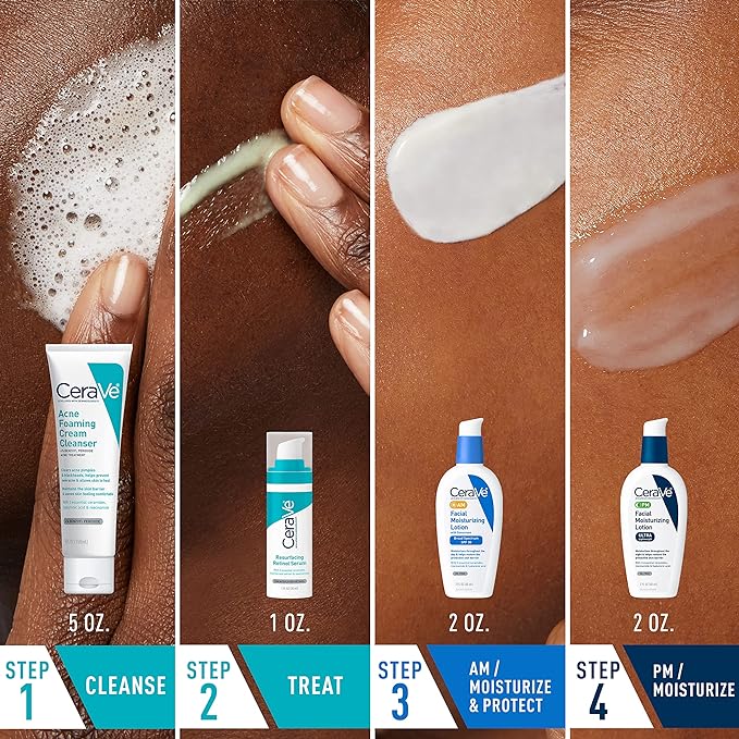 CeraVe Acne Skin Care Set, 5oz Acne Foaming Cream Cleanser + 1oz Resurfacing Retinol Serum + 2oz AM Facial Moisturizing Lotion with SPF 30 + 2oz PM Facial Moisturizing Lotion