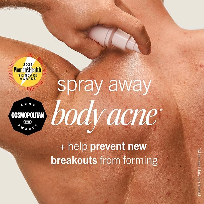 First Aid Beauty Body Acne Spray - Maximum Strength Body Acne Treatment With 360-Degree Sprayer - 2% Salicylic Acid Formula, (3.0 oz)