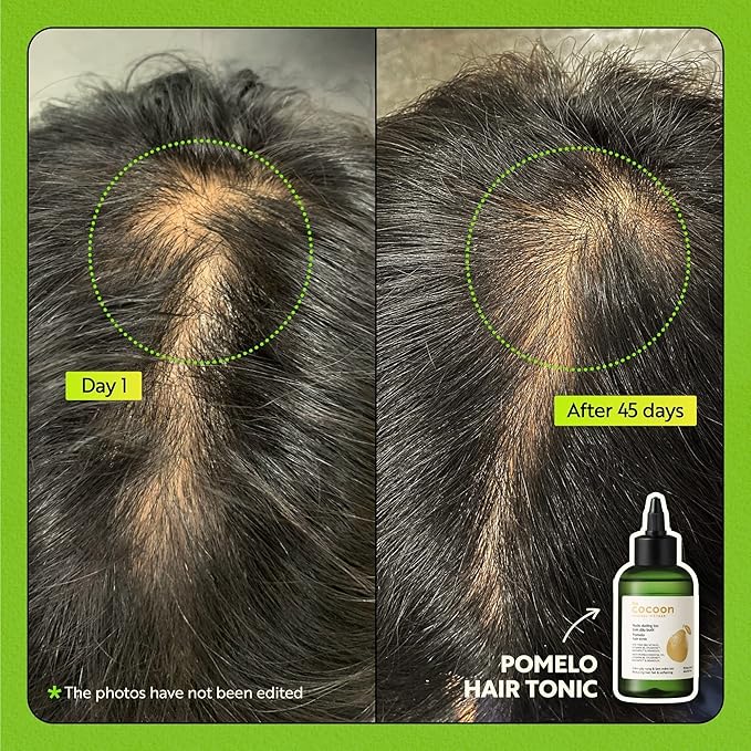 Cocoon Pomelo Grapefruit Oil Hair Tonic, Hair Growth Serum, Vegan Scalp Serum Treatment for Thinning, Damaged & Breakage Hair | Soften, Reduce Hair Loss & Promote Hair Growth | 4.73 fl oz